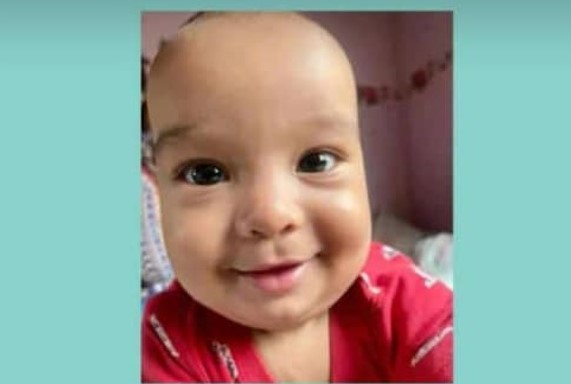 A los nueve meses de nacido Sebastián Martínez fue operado de una obstrucción intestinal y requiere ayuda económica para su tratamiento