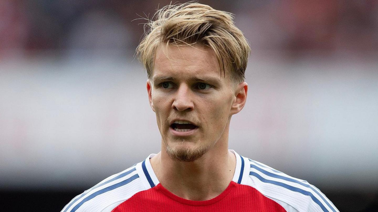 Martin Odegaard sufrió lesión y estará alejado de las canchas por dos meses. Foto: RRSS