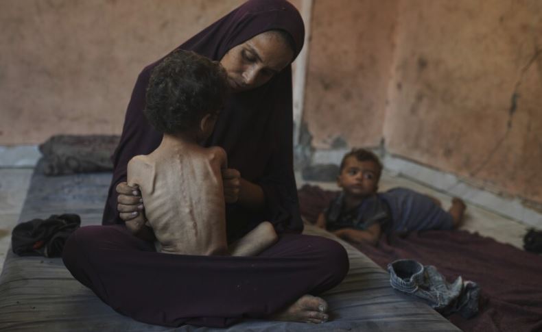 Decenas de niños y adultos en Gaza murieron de hambre en julio: imágenes son desgarradoras