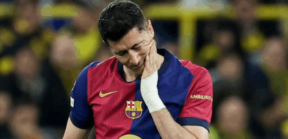 Lewandowski se lesiona y es duda para el Clásico