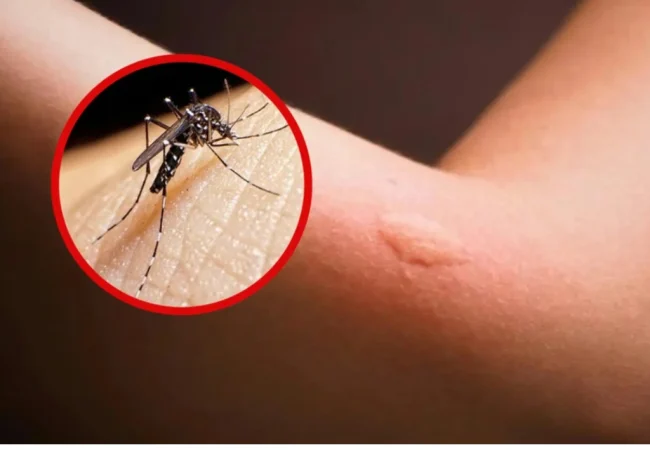 Florida reporta el mayor brote de dengue de EEUU en más de una década: Más de 250 casos