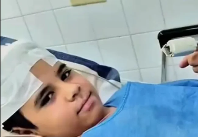 Niño falconiano que sufrió descarga eléctrica en abril fue dado de alta este lunes 5-Oct en Maracaibo